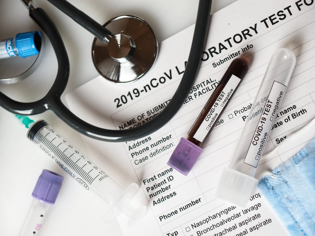 Coronavirus COVID-2019 test concept