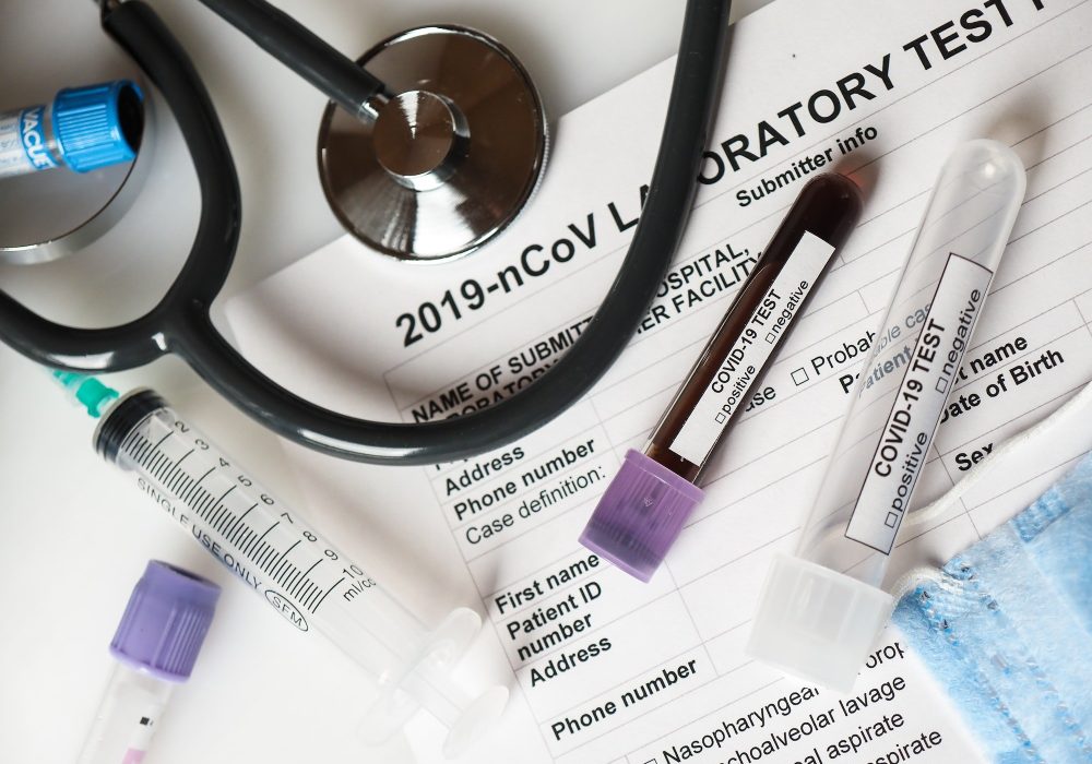 Coronavirus COVID-2019 test concept